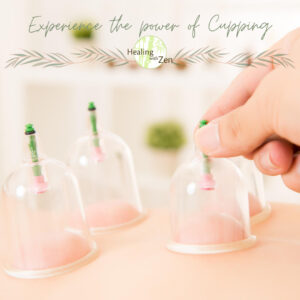 Healing with Zen, Acupuncture, Cupping, Herbal Remedies